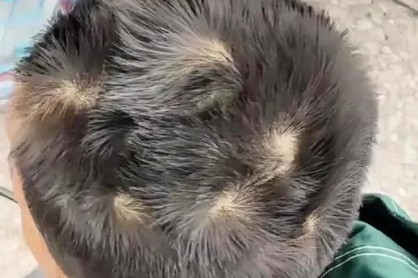 男孩头顶的三个旋：揭开命运的面纱，你还在错过吗？